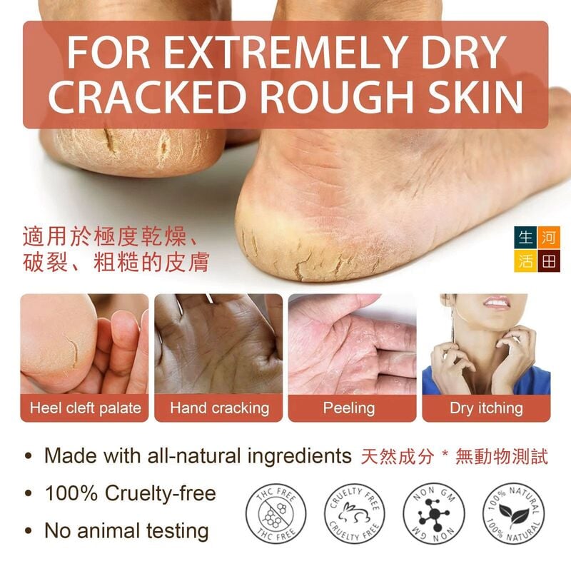 South Moon足跟修護膏(20g)│足部去死皮│去角質護足膏│防乾裂老繭嫩腳