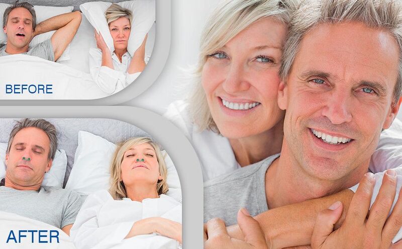 Snore Aid鼻腔擴張器-防止減低鼻鼾 (一套4個）