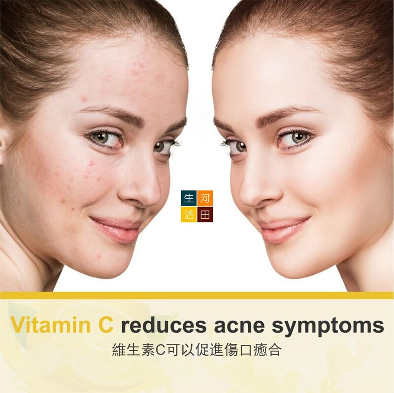 ELAIMEI維他命VC乳霜(50ML)│滋潤保濕│清爽不油膩│提亮肌膚│維C乳霜