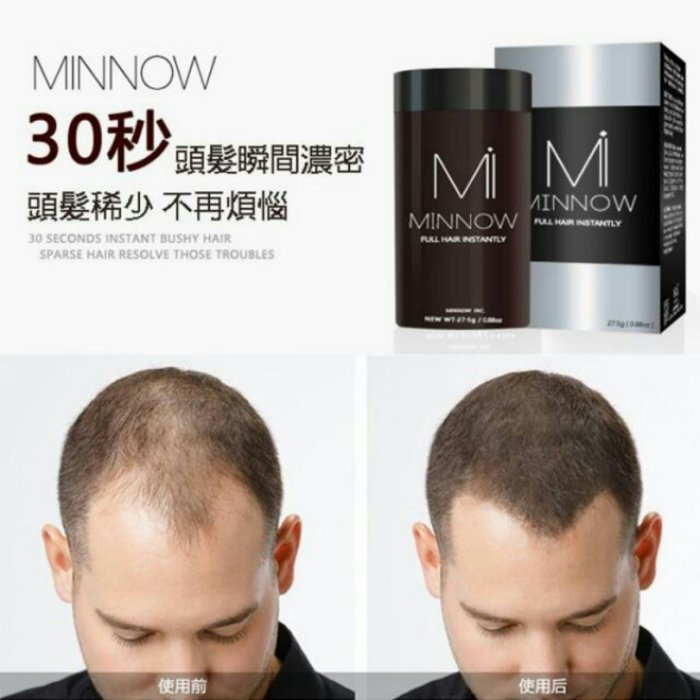 Minnow增髮纖維25g髮量濃密發寶脫髮密髮豐頂禿頭救星(男女都可用)
