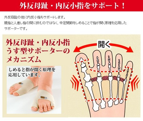 日本⭐️腳指外翻矯正帶