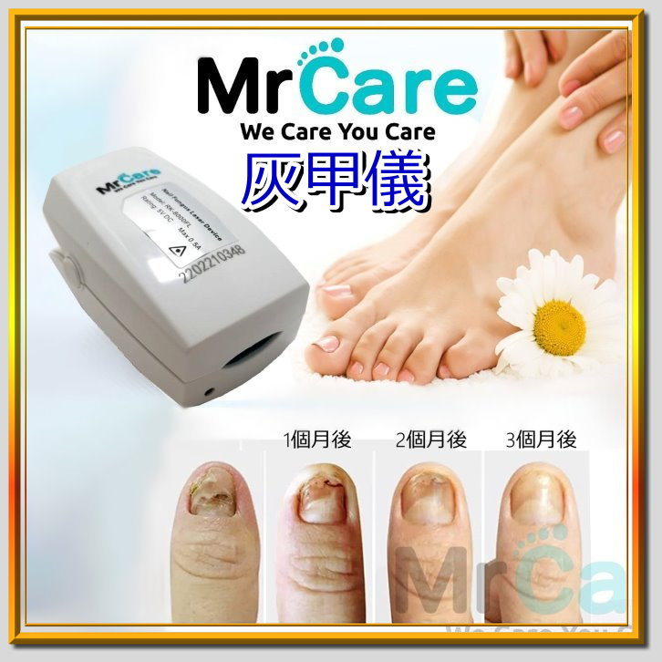 Mr Care 非藥物治理灰甲激光儀 (第二代)[RK-6000FL]