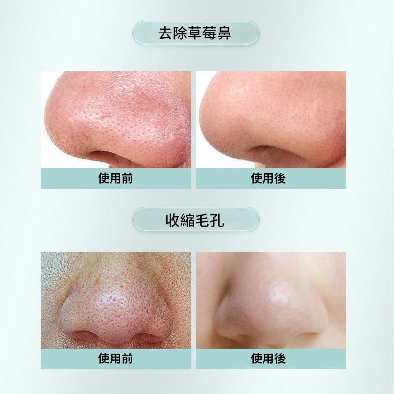 日本JUJY紀芝 Aqua Peeling 灌膚級家用智能暖吸冷收毛孔清潔機|FC3001 日本JUJY紀芝 Aqua Peeling 灌膚級家用智能暖吸冷收毛孔清潔機|FC3001