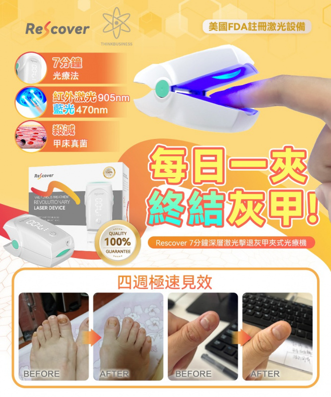美國Rescover 7分鐘深層激光擊退灰甲夾式光療機