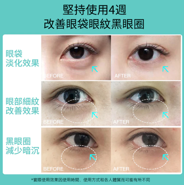 日本 JUJY 逆齡多極射頻美眼儀 日本 JUJY 逆齡多極射頻美眼儀