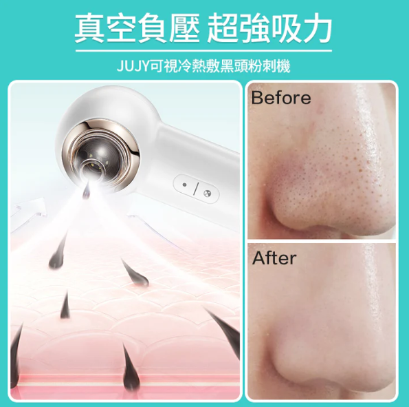 日本 JUJY 可視冷熱敷 黑頭粉刺機 日本 JUJY 可視冷熱敷 黑頭粉刺機