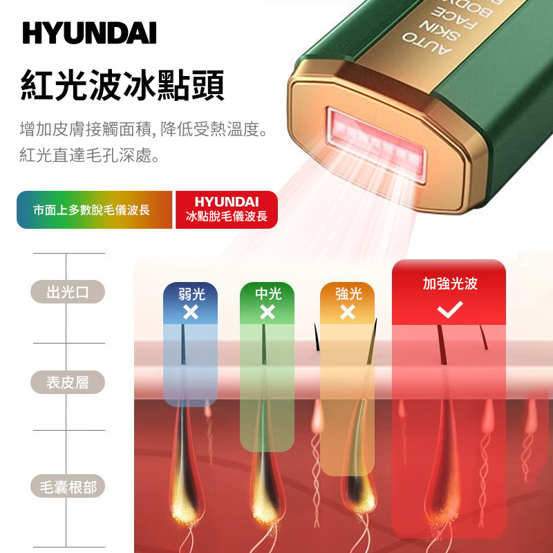HYUNDAI IPL 冰點激光脫毛儀
