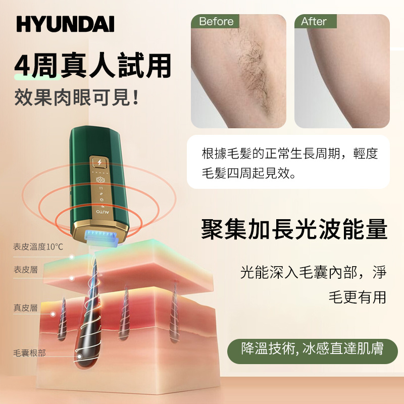 HYUNDAI IPL 冰點激光脫毛儀