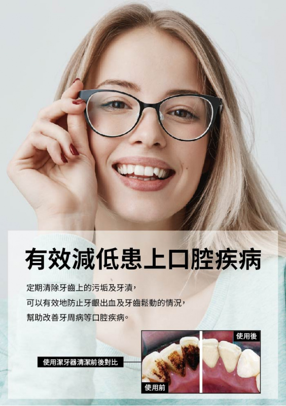 Maxcare 超聲波離子洗牙器