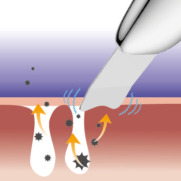 TOUCHBeauty - TB1769 超聲波美容儀