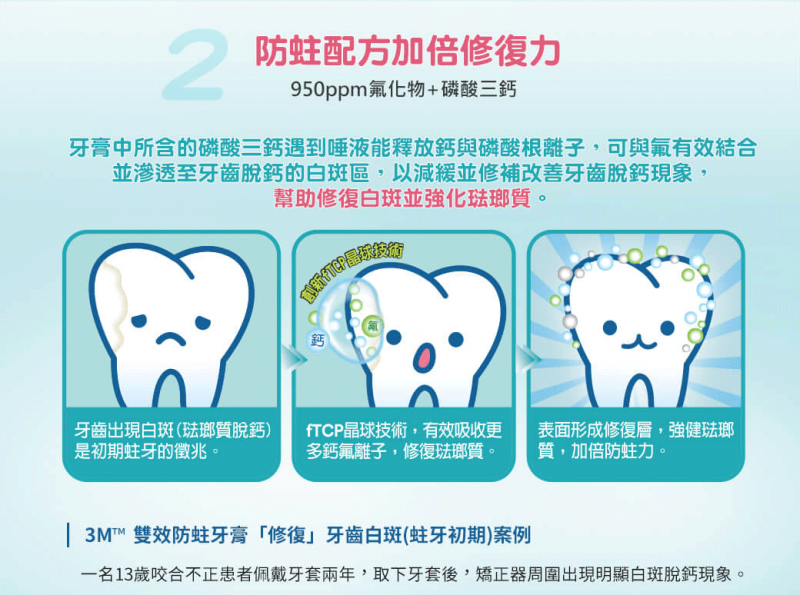 美國製 3M™ - ESPE Clinpro™雙效防蛀牙霜(含磷酸三鈣) 113g