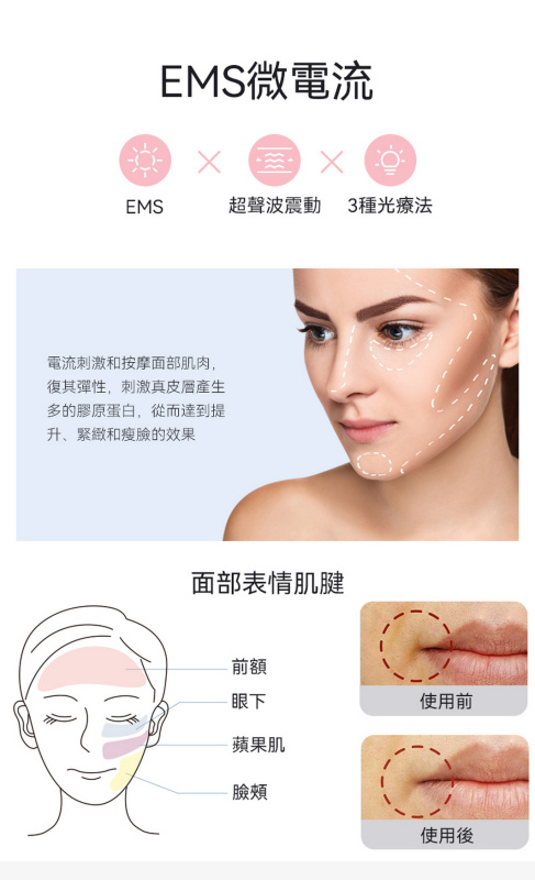 日本ANLAN - EMS彩光冷熱導入儀 (白色) ADRY15-001｜三色LED光療儀｜光療機｜離子導入導出機｜多功能美容儀【送Kusa納米補水器】