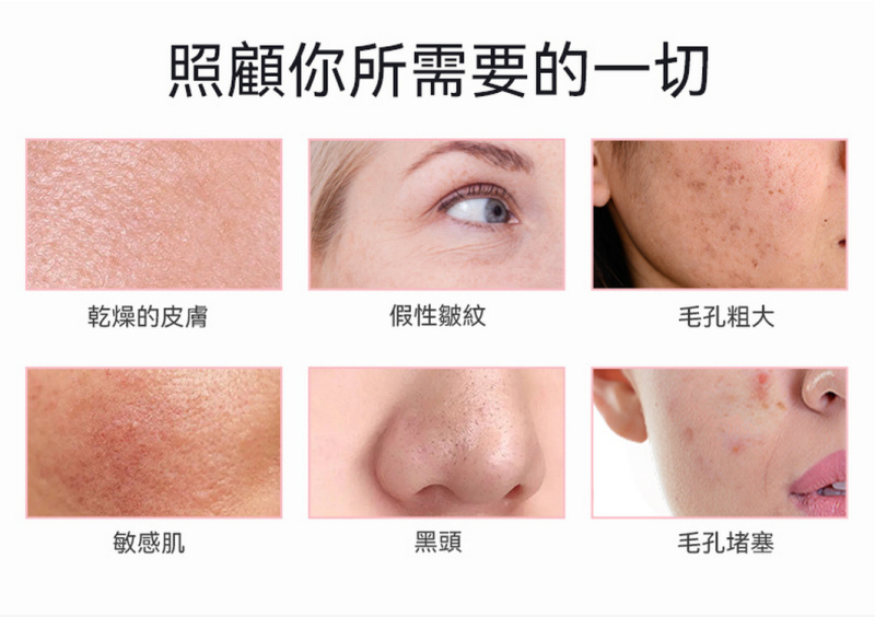 日本ANLAN - EMS彩光冷熱導入儀 (白色) ADRY15-001｜三色LED光療儀｜光療機｜離子導入導出機｜多功能美容儀【送Kusa納米補水器】