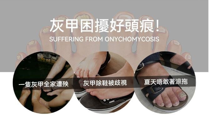 Rescover 7分鐘深層激光擊退灰甲夾式光療機