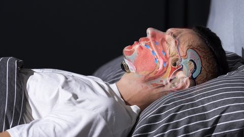 Sleepmi Z3 第三代 EMS止鼾睡眠偵測器