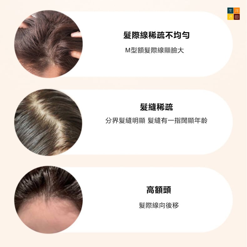 O'CHEAL柔霧髮際線粉 | 髮線後移修容粉 | 頭髮蓬鬆陰影粉 O'CHEAL柔霧髮際線粉 | 髮線後移修容粉 | 頭髮蓬鬆陰影粉