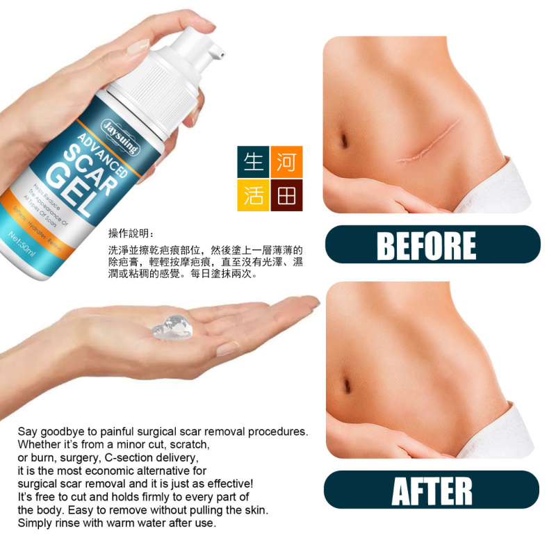 淡化傷疤平滑肌膚除疤膏|燙燒疤手術修護霜|產後产后妊娠纹凝膠|增生皮膚傷痕修复肌肤霜