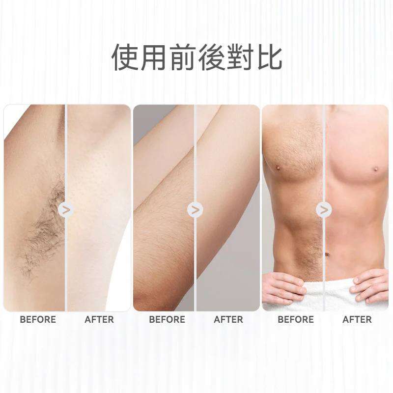 Ulike 藍寶石 Air3 三週見效冰點家用脫毛儀 UI06 PN [時送 GLAMM CO 精選護膚品]