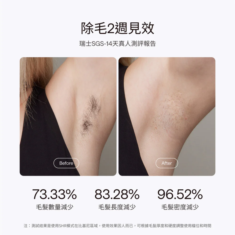 Ulike Air10 家用脫毛儀 (UI20 DB)[限時送 GLAMM CO 精選護膚品]