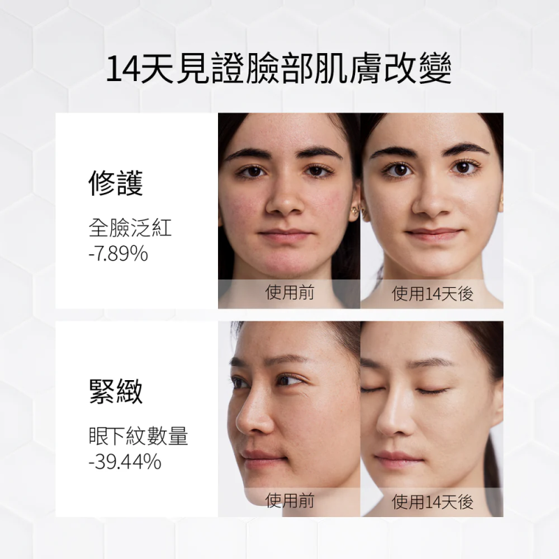 Ulike 白皇后LED美容面膜儀 UM10 [送 GLAMM CO 精選護膚品]