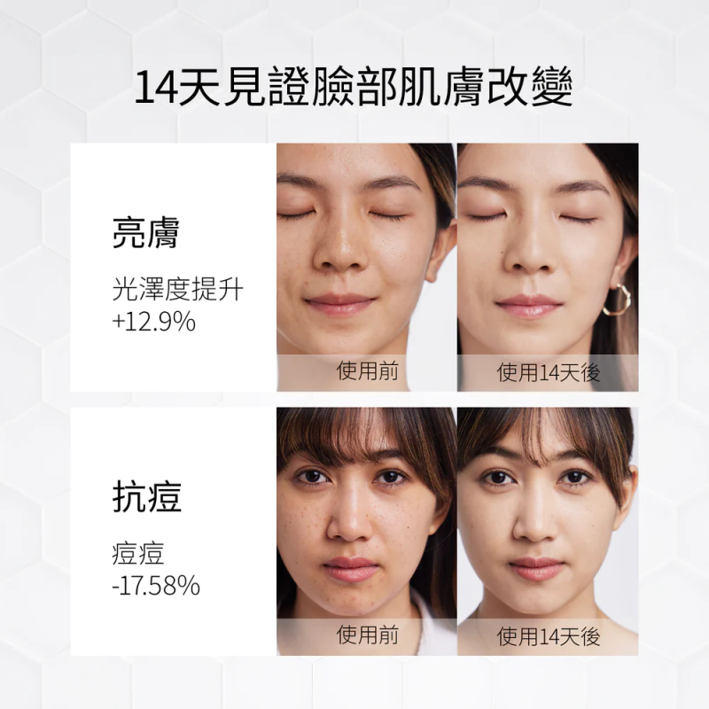 Ulike 白皇后LED美容面膜儀 UM10 [送 GLAMM CO 精選護膚品]