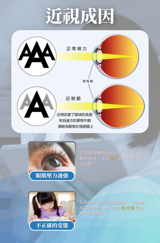 Green Island低頻脈衝眼部護理儀 EPE-10 送一張百佳50元現金卷