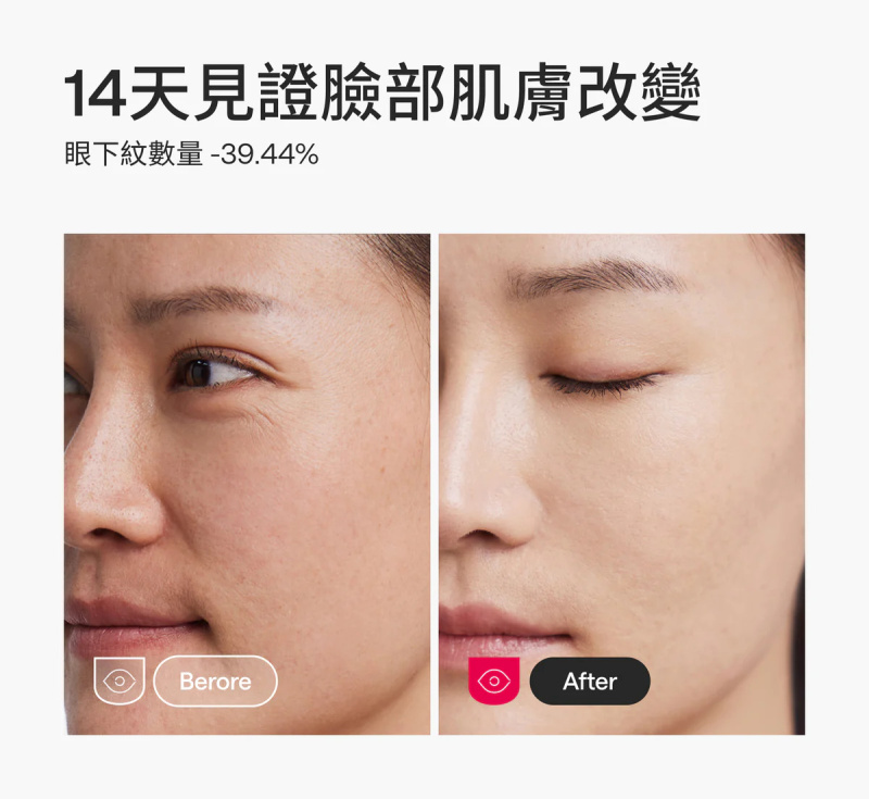 【免運費】Ulike白皇后LED美容面膜儀【原裝行貨】