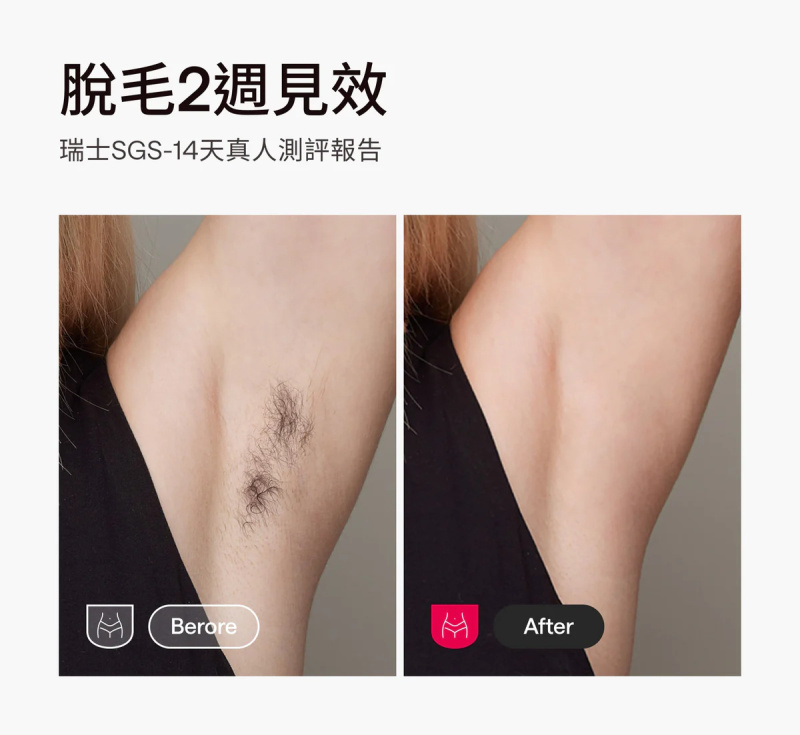 【免運費】Ulike Air10家用脫毛儀【原裝行貨】