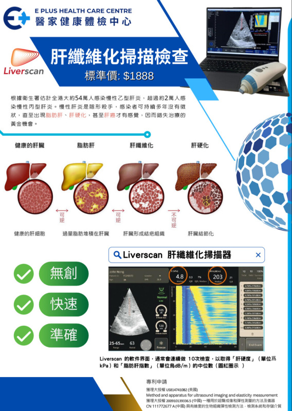 肝纖維化掃描檢查