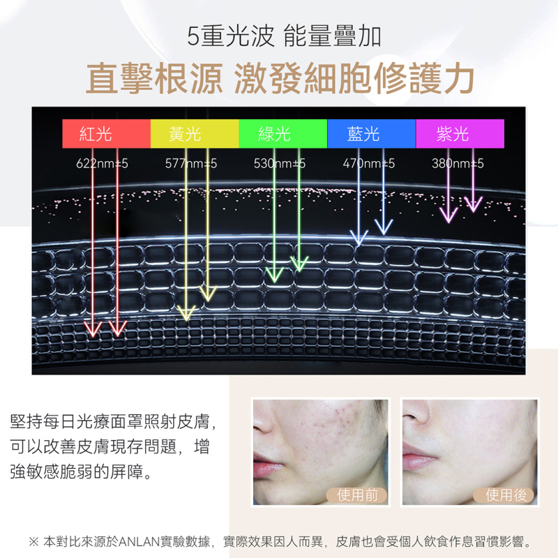 日本ANLAN - LED 充電發熱柔性光子面膜罩 AGZMZ31-04E｜彩光面罩｜LED面罩｜光療面膜儀｜光療面罩 【香港行貨】