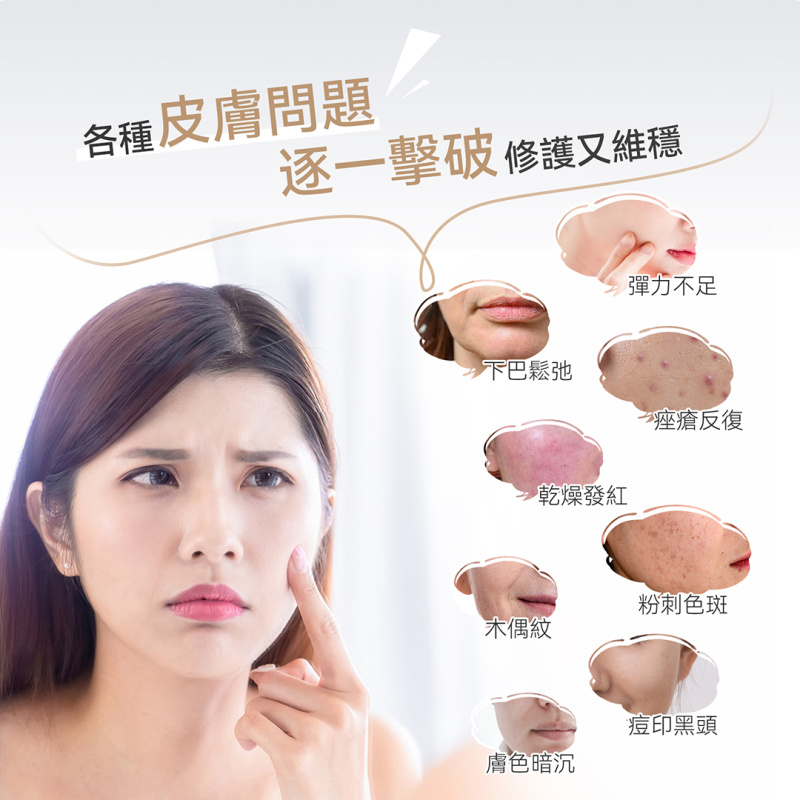 日本ANLAN - LED 充電發熱柔性光子面膜罩 AGZMZ31-04E｜彩光面罩｜LED面罩｜光療面膜儀｜光療面罩 【香港行貨】