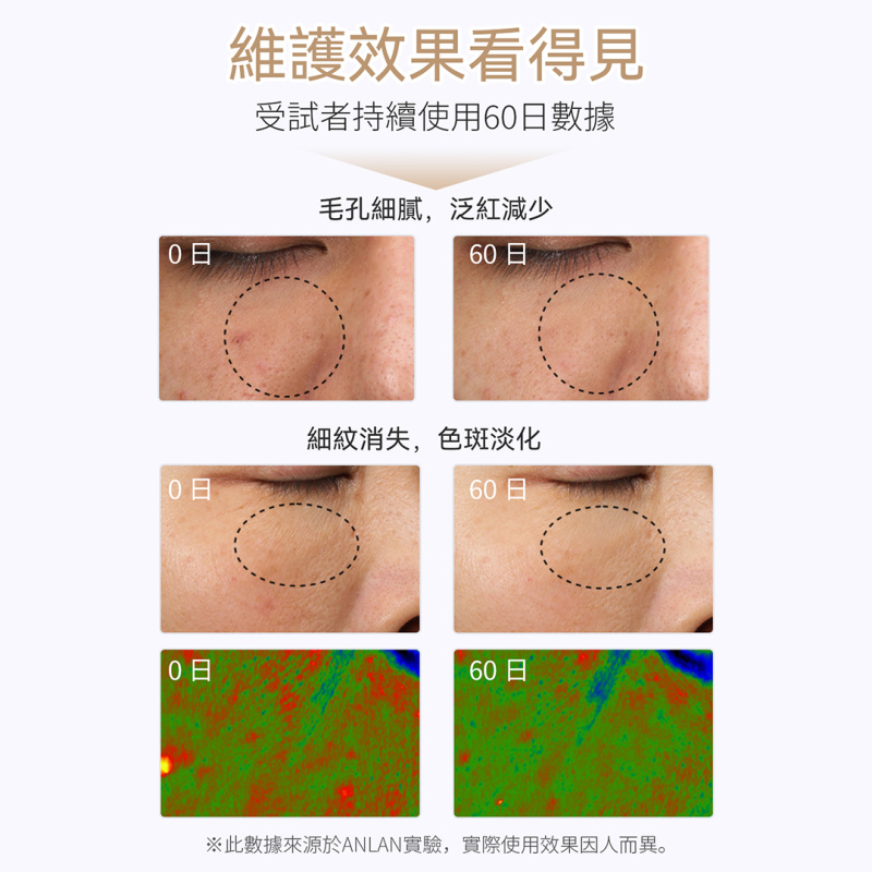 日本ANLAN - LED 充電發熱柔性光子面膜罩 AGZMZ31-04E｜彩光面罩｜LED面罩｜光療面膜儀｜光療面罩 【香港行貨】