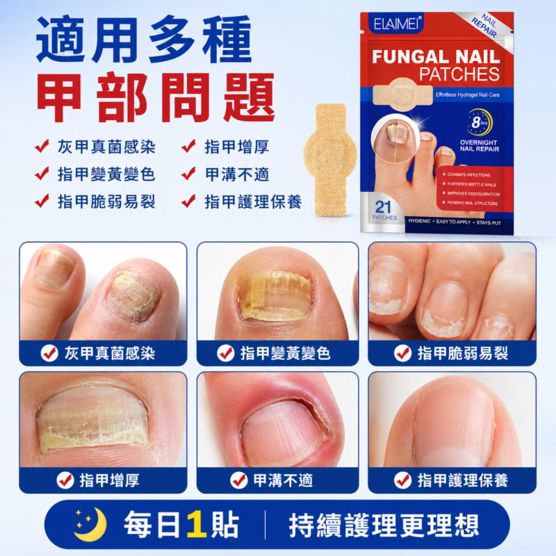 Elamei 夜間灰甲修護貼(21片) | 指甲修復矯正 嵌甲 甲溝發炎 護甲 | 腳指甲真菌護理貼