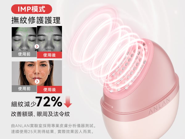 ANLAN - RoseLumi 修護儀 APMRY53-04A