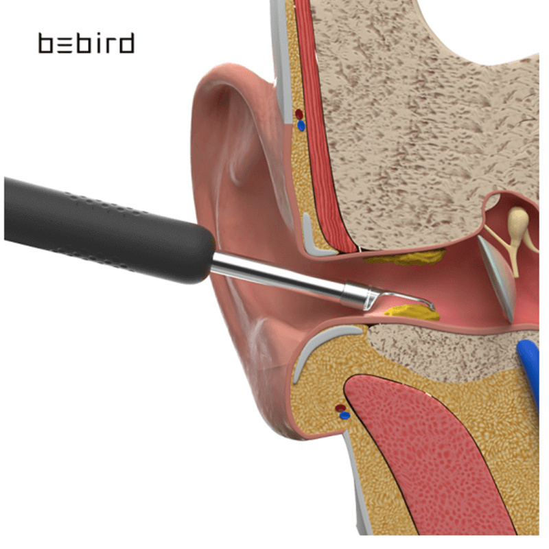 BEBIRD R1 採耳神器 Smart Ear Cleaning Stick