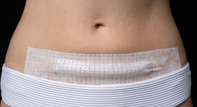 智慧平疤貼條裝