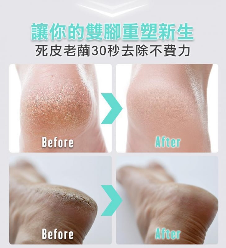 台灣 Future Lab 6S手足修磨儀