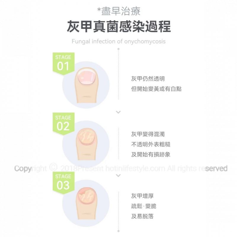 NEWEDO 灰甲激光治療儀