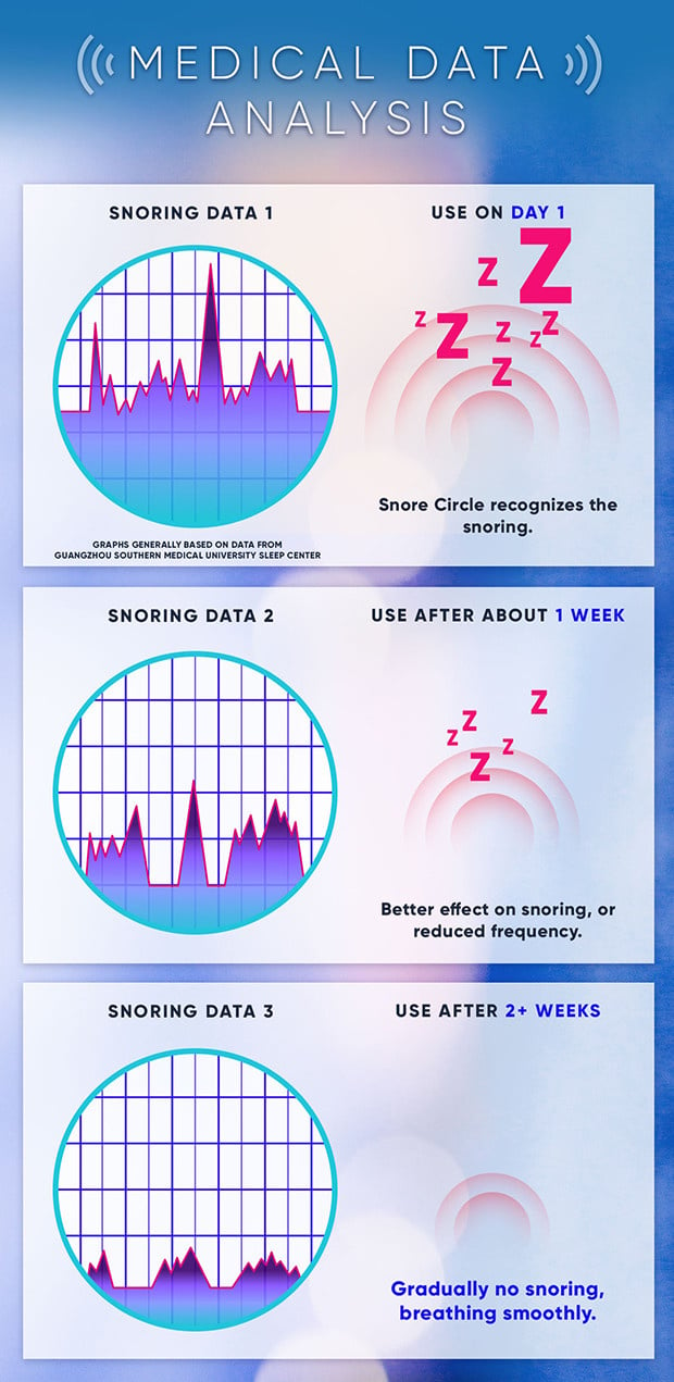 Price網購 Snore Circle 智能止鼾器