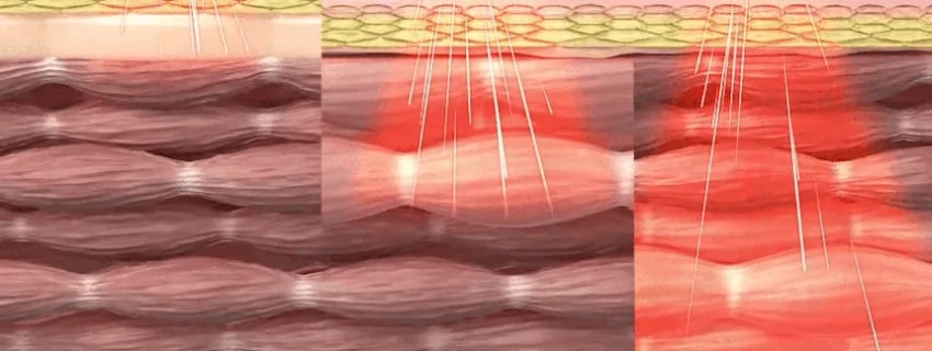 1 (16).webp