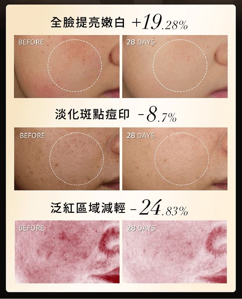 全臉提亮嫩白+19.28%；淡化斑點痘印-8.7%；泛紅區域減輕-24.83%