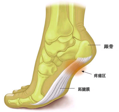 MEDEX 矽膠腳後跟鞋墊 (F02)