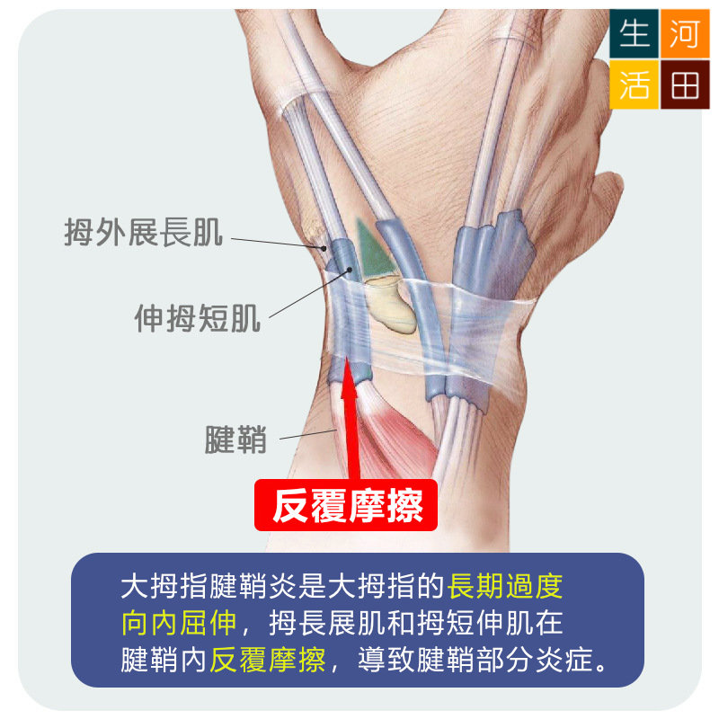 超薄拇指護套 腱鞘關節護腕 大拇指矯正固定保護帶  彈弓手舒緩帶