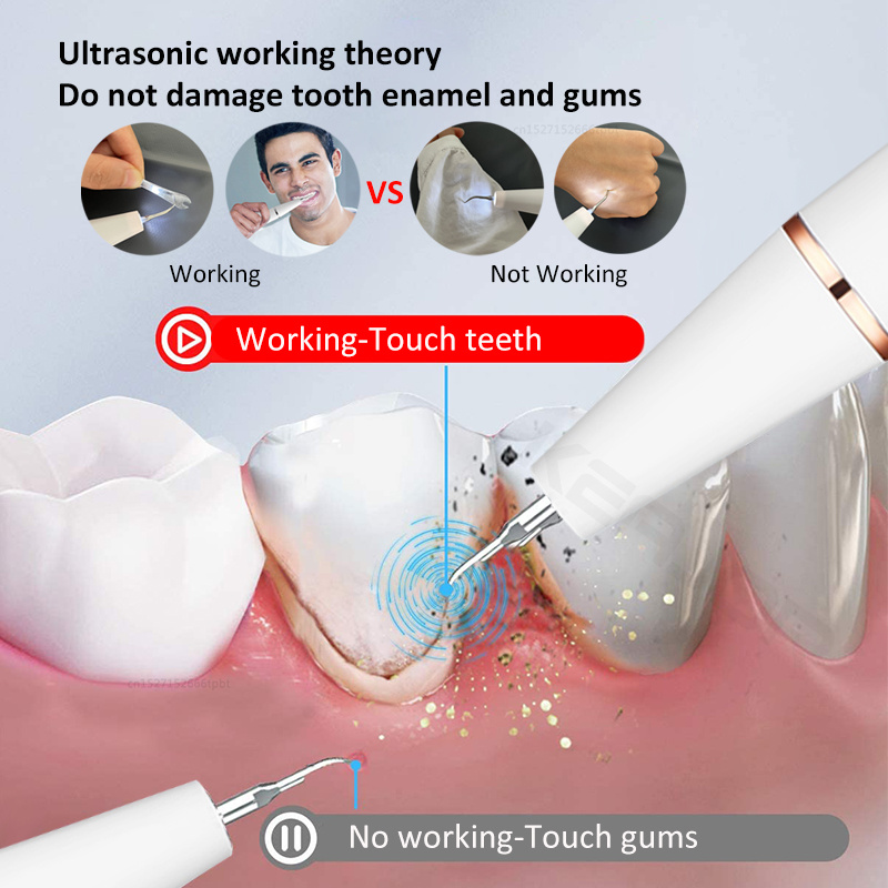 洗牙Electric Sonic Dental Calculus Scaler Oral Teeth Tartar Remover Plaque Stains Cleaner Removal Teeth Whitening Portable with LED